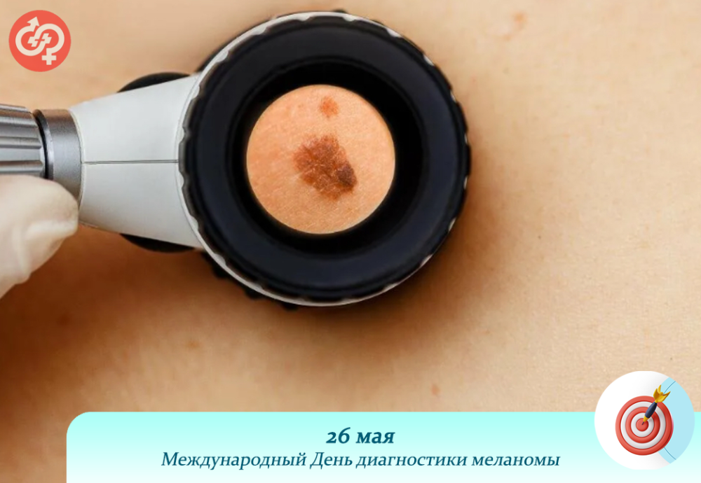 26 мая Международный День диагностики меланомы